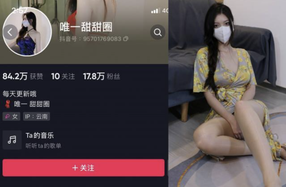 唯一甜甜圈 微密圈合集[8套][持续更新]-小爱·美女部落